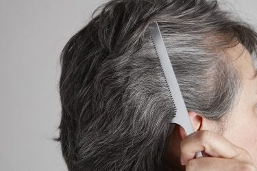Premature Grey Hair: Causes And Prevention
