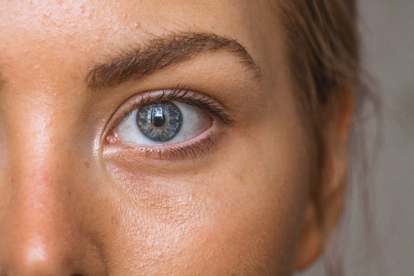5 DIY Natural Remedies for tired eyes